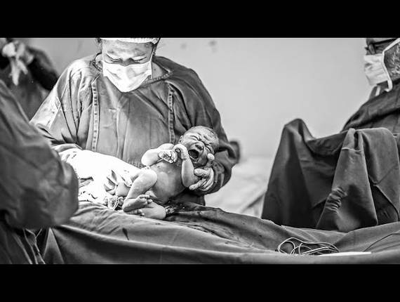 Parto Cesárea de Nascimento Alice