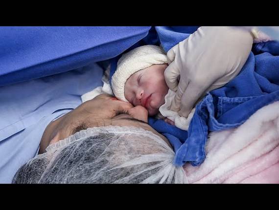 Parto Cesárea de Nascimento Heloísa