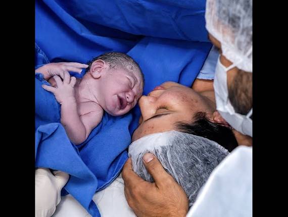 Parto Cesárea de Nascimento Conrado