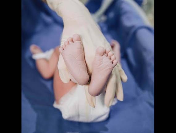 Parto Cesárea de Nascimento Lorenzo