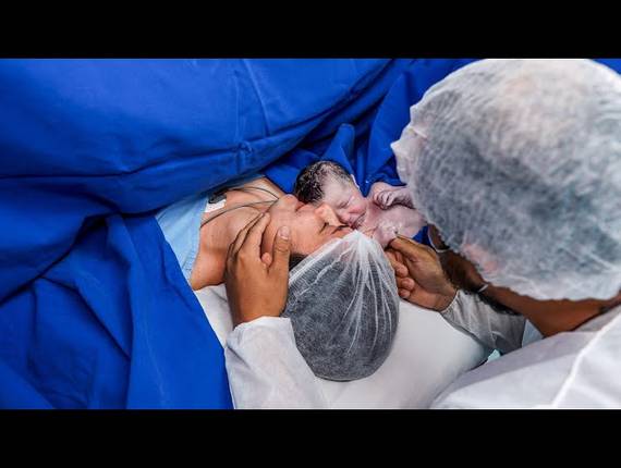 Parto Cesárea de Nascimento Bento