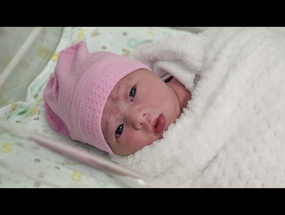 Parto Cesárea de Nascimento Liz