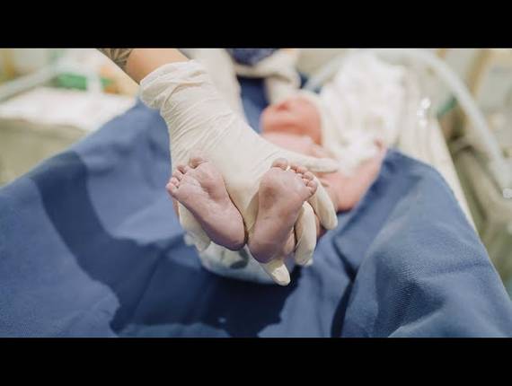 Parto Cesárea de Nascimento Henry