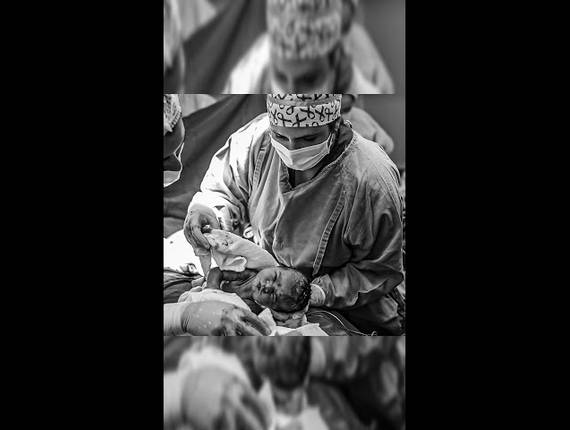 Parto Cesárea de Nascimento Manuela