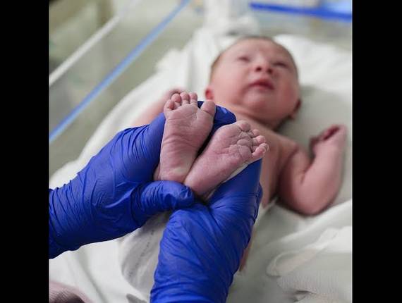 Parto Cesárea de Nascimento Melissa