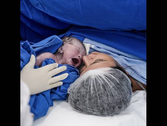 Parto Cesárea de Nascimento Manuela