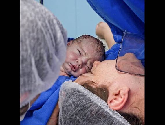 Parto Cesárea de Nascimento Leonardo