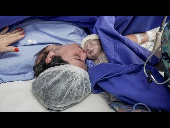 Parto Cesárea de Nascimento Leonardo