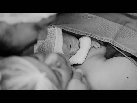 Parto Cesárea de Nascimento Yuri