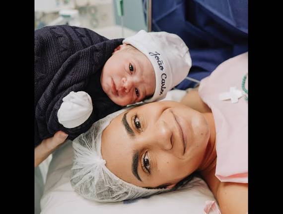 Parto Cesárea de Nascimento João Carlos