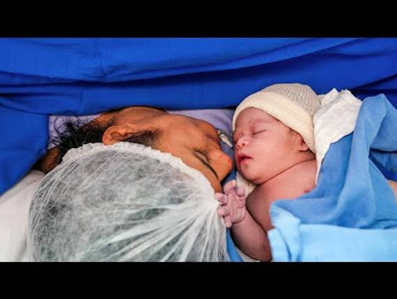 Parto Cesárea de Nascimento Matheus Henrique