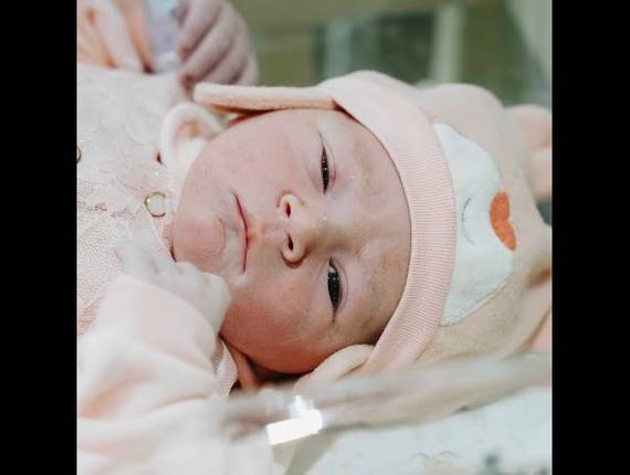 Parto Cesárea de Nascimento Heloisa