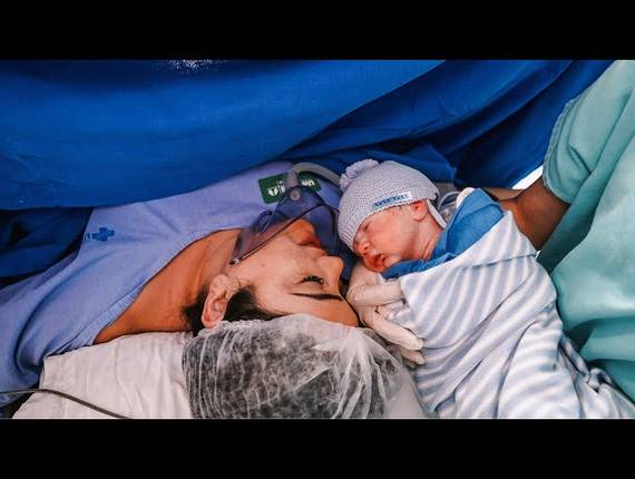 Parto Cesárea de Nascimento Miguel 