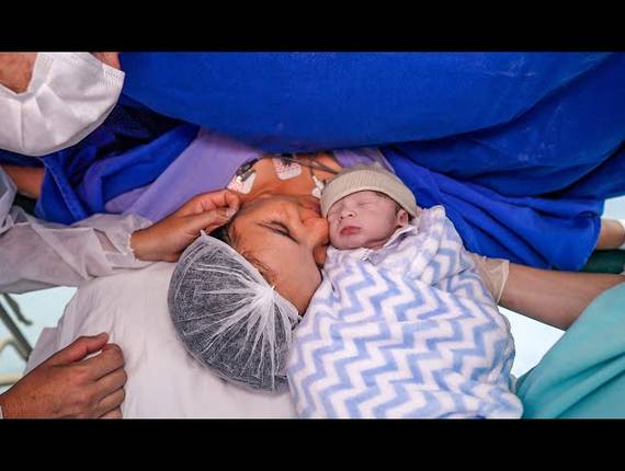 Parto Cesárea de Nascimento Felipe