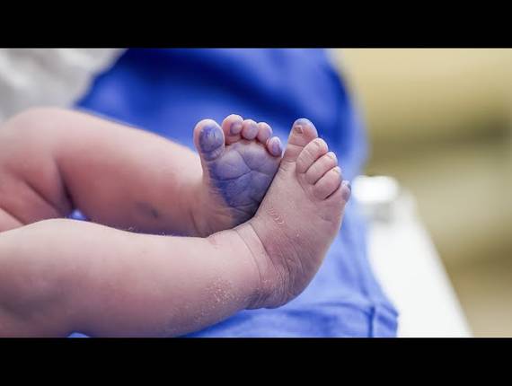 Parto Cesárea de Nascimento Isabel 