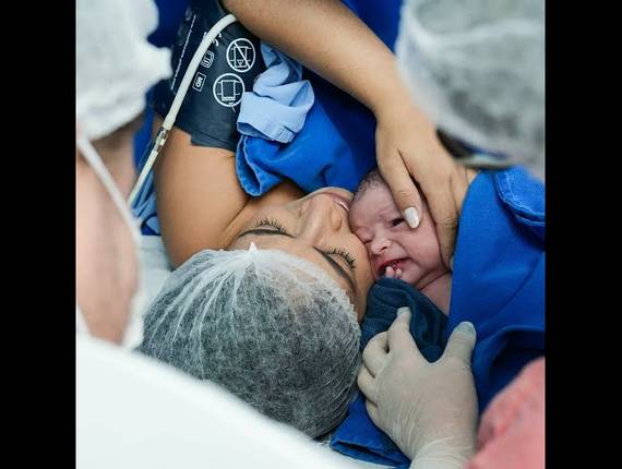 Parto Cesárea de Nascimento Lucas