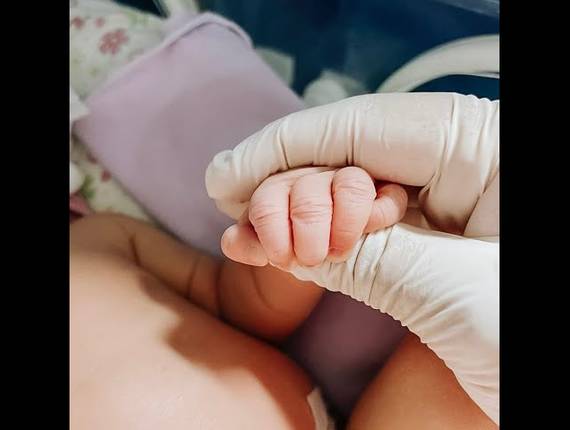 Parto Cesárea de Nascimento Eva