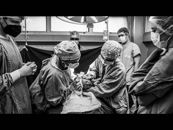 Parto Cesárea de Nascimento Pedro