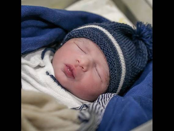 Parto Cesárea de Nascimento Levi 