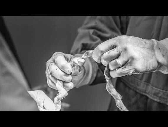 Parto Cesárea de Nascimento Luise