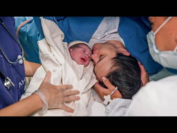 Parto Cesárea de Nascimento Clara