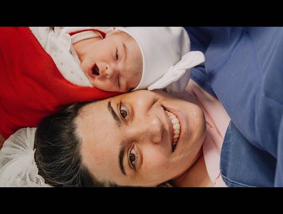 Parto Cesárea de Nascimento Alice