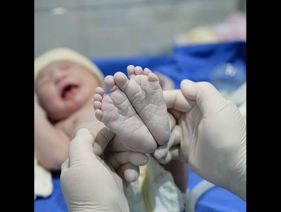 Parto Cesárea de Nascimento Diana