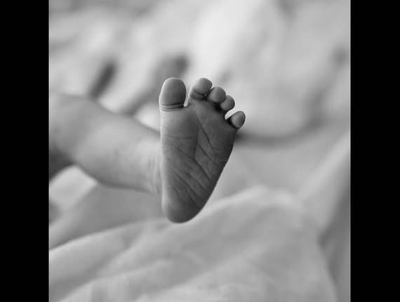 Parto Cesárea de Nascimento Ravi 