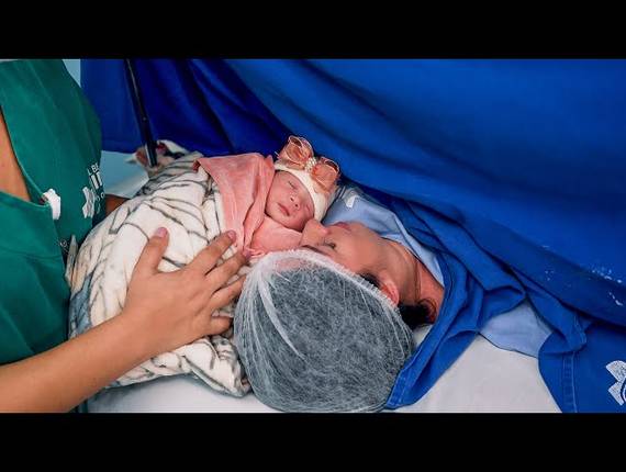 Parto Cesárea de Nascimento Maite