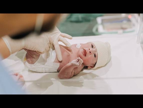 Parto Cesárea de Nascimento Liz