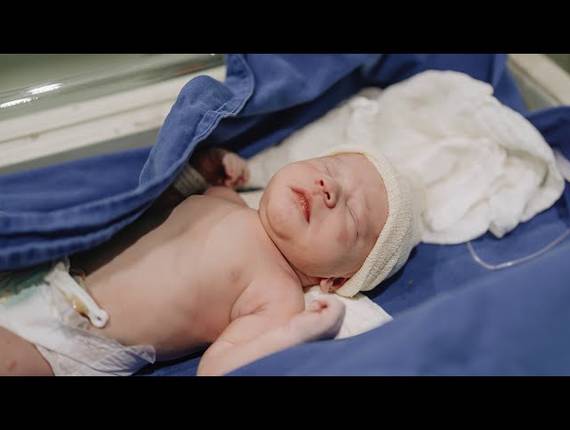 Parto Cesárea de Nascimento Joao Lucas