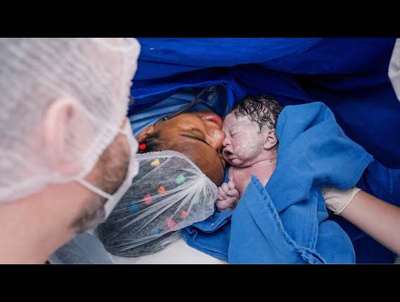 Parto Cesárea de Nascimento Bernardo José