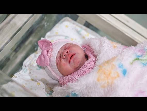 Parto Cesárea de Nascimento Alice