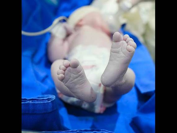 Parto Cesárea de Nascimento Rafael Augusto