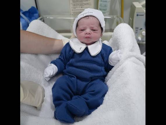 Parto Cesárea de Nascimento Joaquim