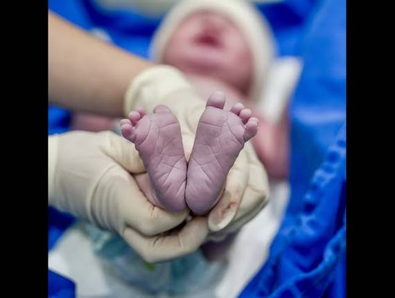 Parto Cesárea de Nascimento Helena