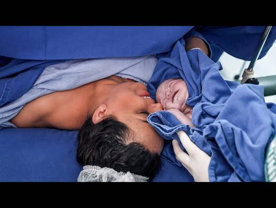 Parto Cesárea de Nascimento Renato