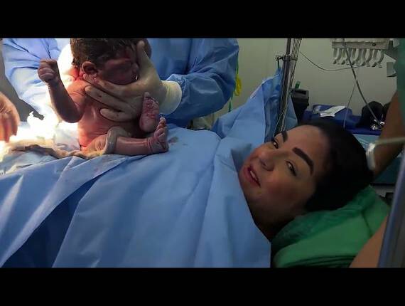 Parto Normal Nascimento Do Ariel Maternidade Perinatal Laranjeiras