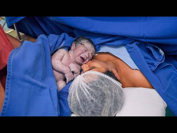 Parto Cesárea de Nascimento Vicente