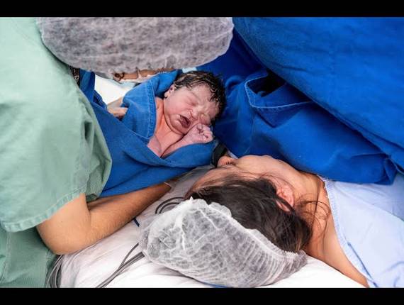 Parto Cesárea de Nascimento Nicolas