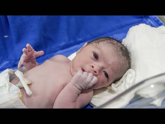 Parto Cesárea de Nascimento Alice Ayumi