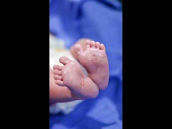 Parto Cesárea de Nascimento André