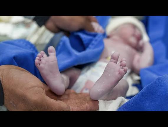 Parto Cesárea de Nascimento Bryan