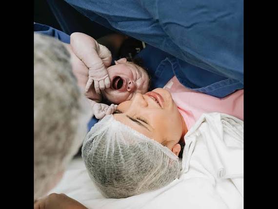 Parto Cesárea de Nascimento Olívia