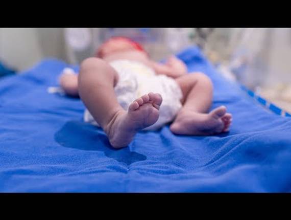 Parto Cesárea de Nascimento Zaya