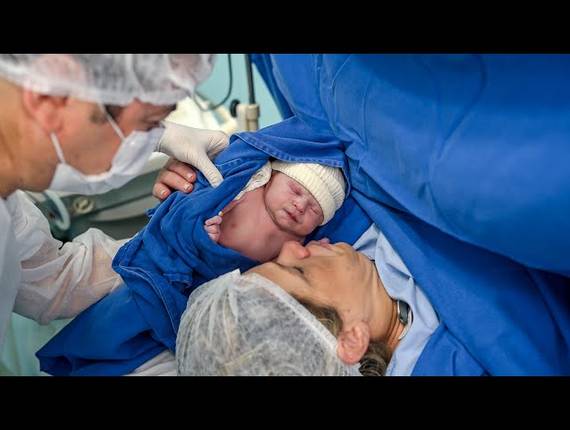 Parto Cesárea de Nascimento Helena