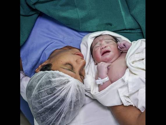 Parto Cesárea de Nascimento Liz