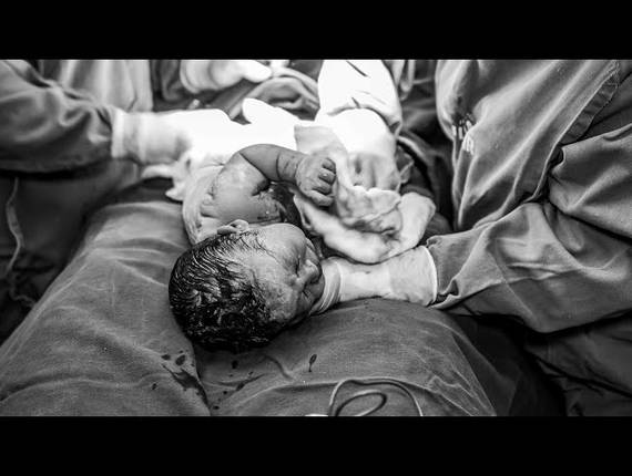 Parto Cesárea de Nascimento Anthony Gabriel