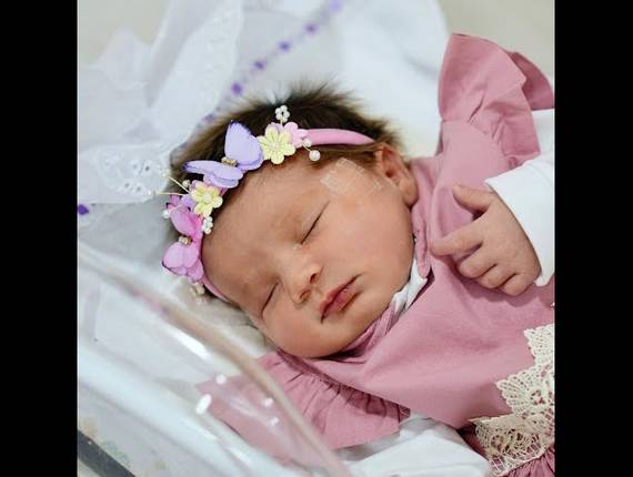 Parto Cesárea de Nascimento Elisa