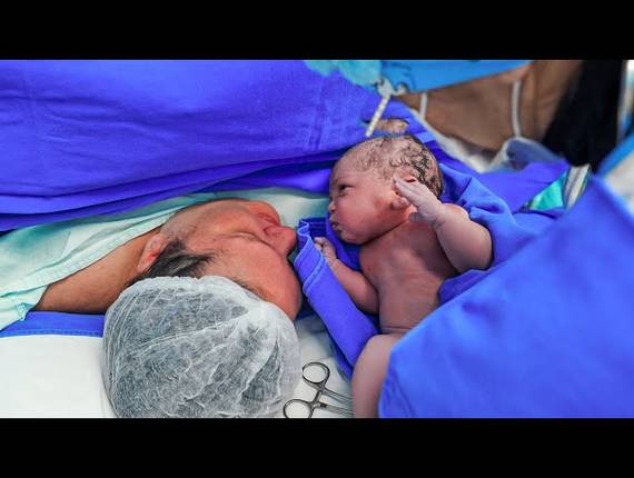 Parto Cesárea de Nascimento Elisa